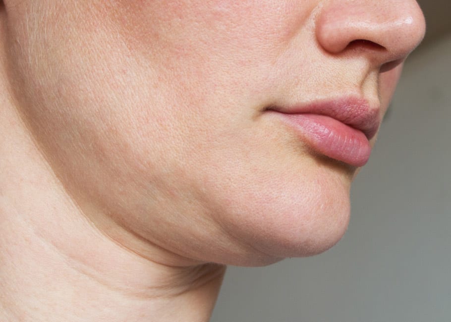 کربوکسی تراپی بهترین روش برای سفتی پوست صورت