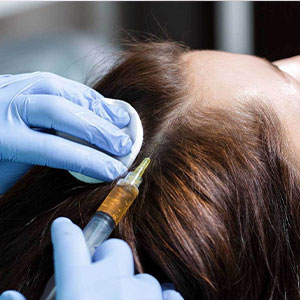 خدمات پی آر پی در کلینیک فوق تخصصی مو