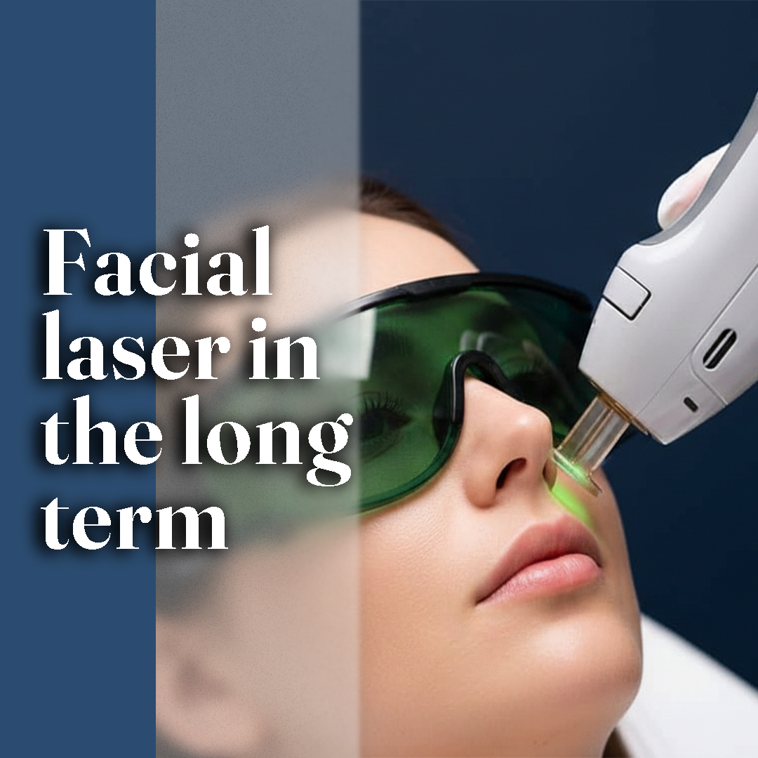 لیزر مو زائد صورت