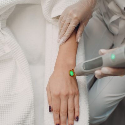 همه چیز درباره لیزر موهای زائد