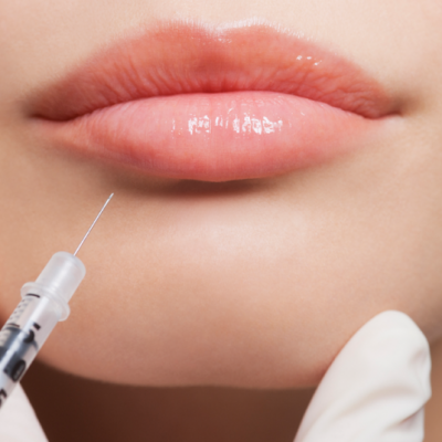 ژل های ژوویدرم (Juvederm)