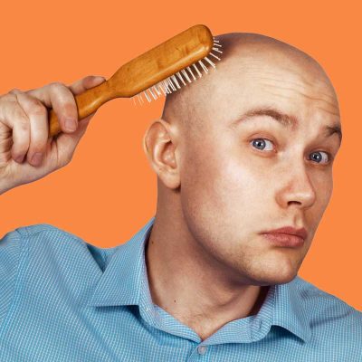 هزینه کاشت موی سر در تهران