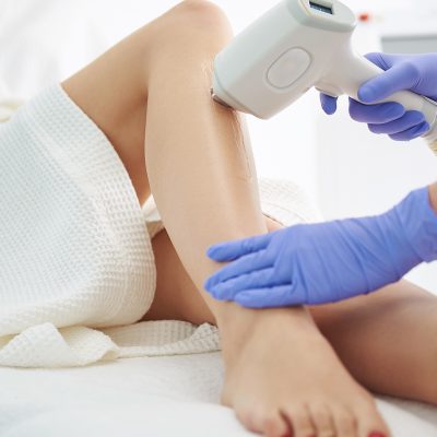 توصیه‌ های بعد از لیزر موهای زائد