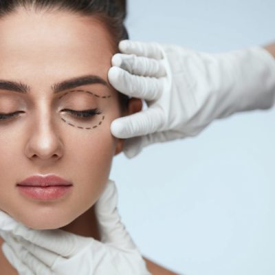 جراحی پلک یا بلفاروپلاستی