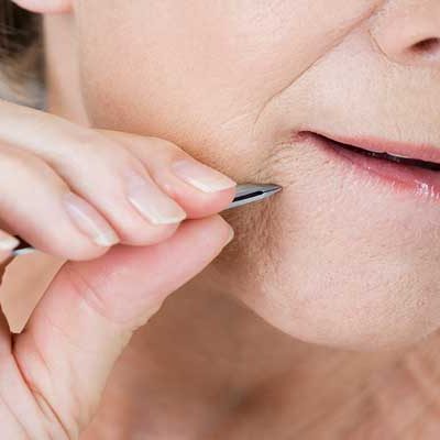 بهترین روش از بین بردن و حذف موهای زائد صورت و بدن