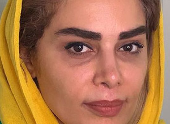 کاشت ابرو سعادت آباد