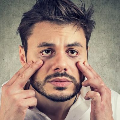 جراحی پلک در مردان