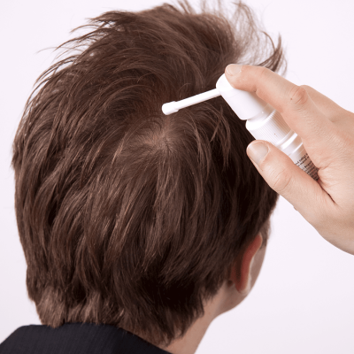 ماینوکسیدیل