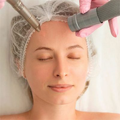 لیزر فوتونا صورت