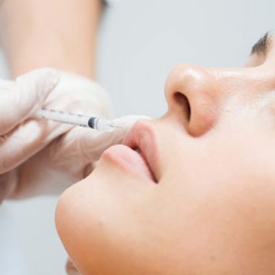 جایگزین پروفایلو