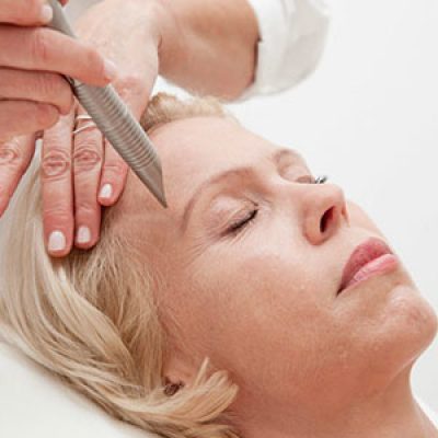 جوانسازی صورت با لیزر فوتونا