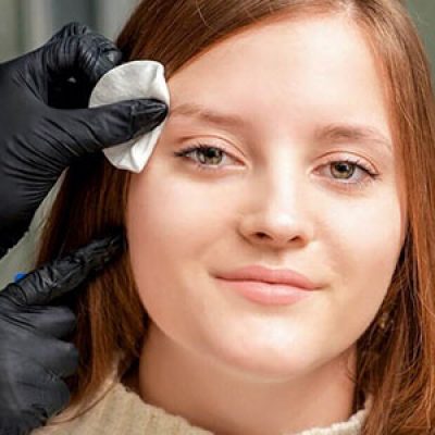 خونریزی بعد از کاشت ابرو