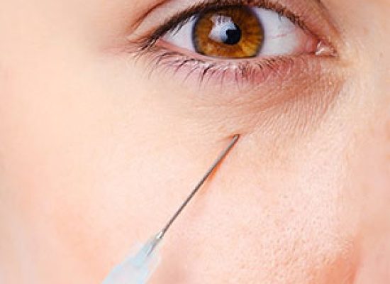 مزایای تزریق پروفایلو دور چشم