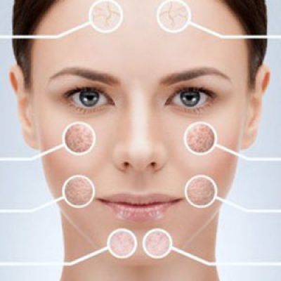 لیزر فوتونا برای ترک پوستی