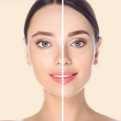 کاشت ابرو تهران