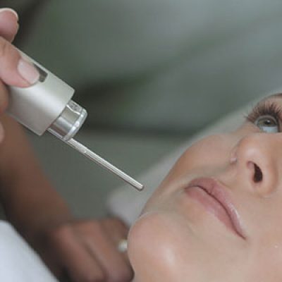 لیزر فوتونا برای جوانسازی