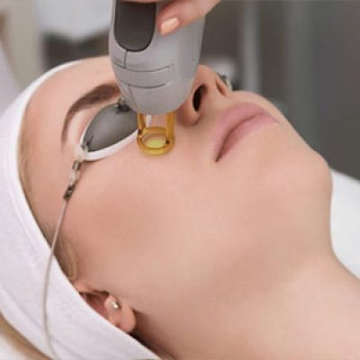 لیزر فوتونا برای جای بخیه