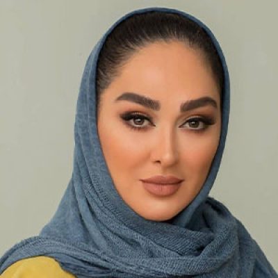 کاشت ابرو بازیگران