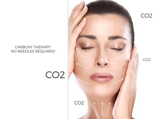 کربوکسی تراپی واژن