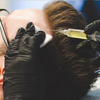 کلینیک مو در تهران