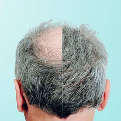 مرکز تخصصی مو در تهران