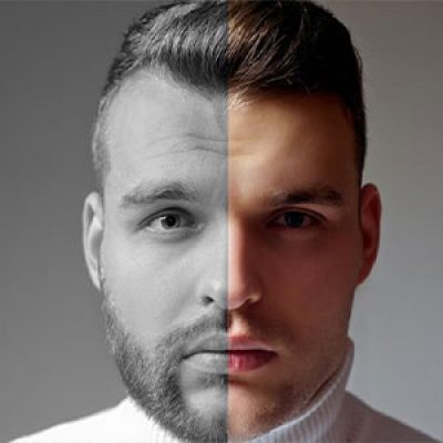 قیمت کاشت ریش و سبیل در تهران