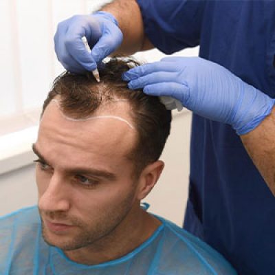 کلینیک کاشت مو جردن تهران