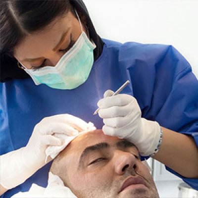 بهترین دکترهای کاشت مو در تهران