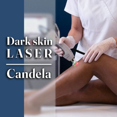 لیزر موهای زائد برای پوست های تیره