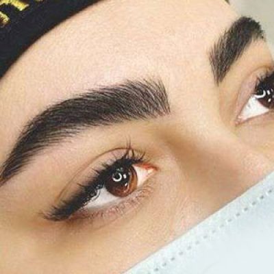 مراکز کاشت ابرو در تهران