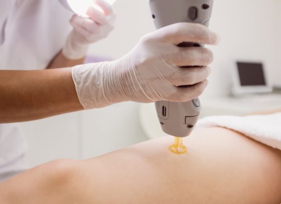 عوارض لیزر موهای زائد