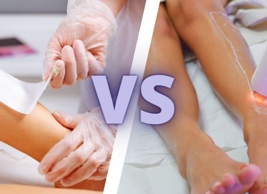 لیزر موهای زائد بهتره یا اپیلاسیون
