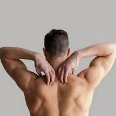 لیزر موهای زائد مردان