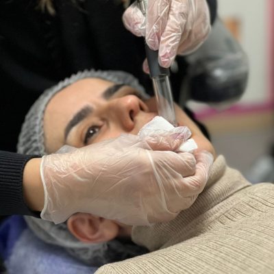 عکس لیزر فوتونا