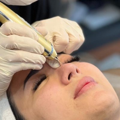 فیشیال صورت بهدیس